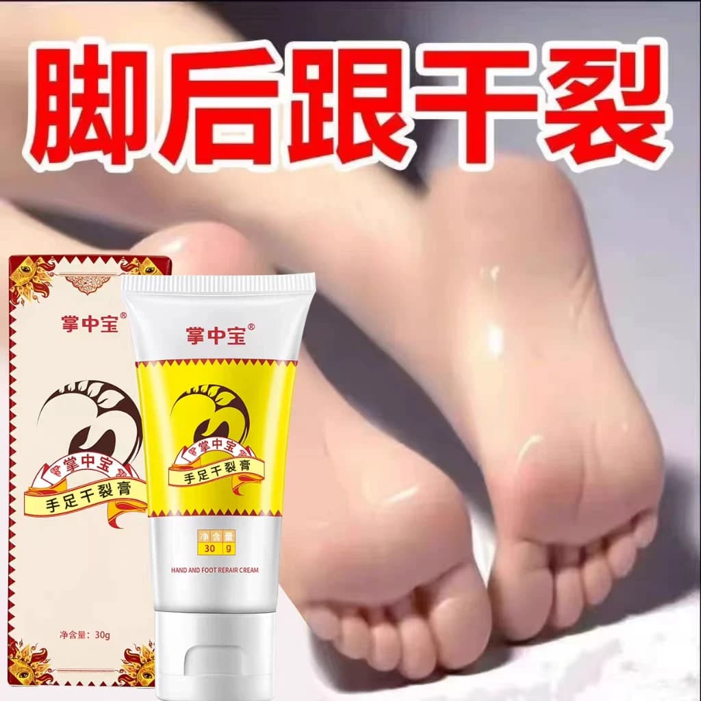 掌中宝干裂修护膏脚后跟皲裂脚裂手裂膏皴裂口龟裂防裂霜护手霜 - 缩略图5