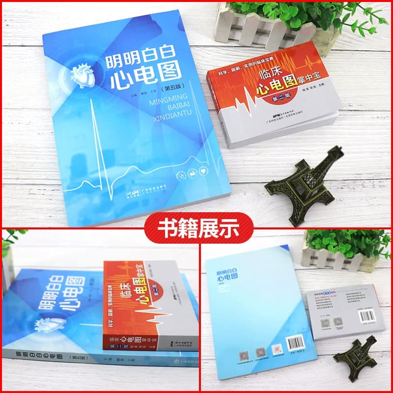 临床心电图掌中宝+明明白白心电图 第5五版 两本套装 广东科学技术出版社 手册入门便携书临床医学书籍诊断分析与诊断正版柳俊黄莺 - 缩略图4