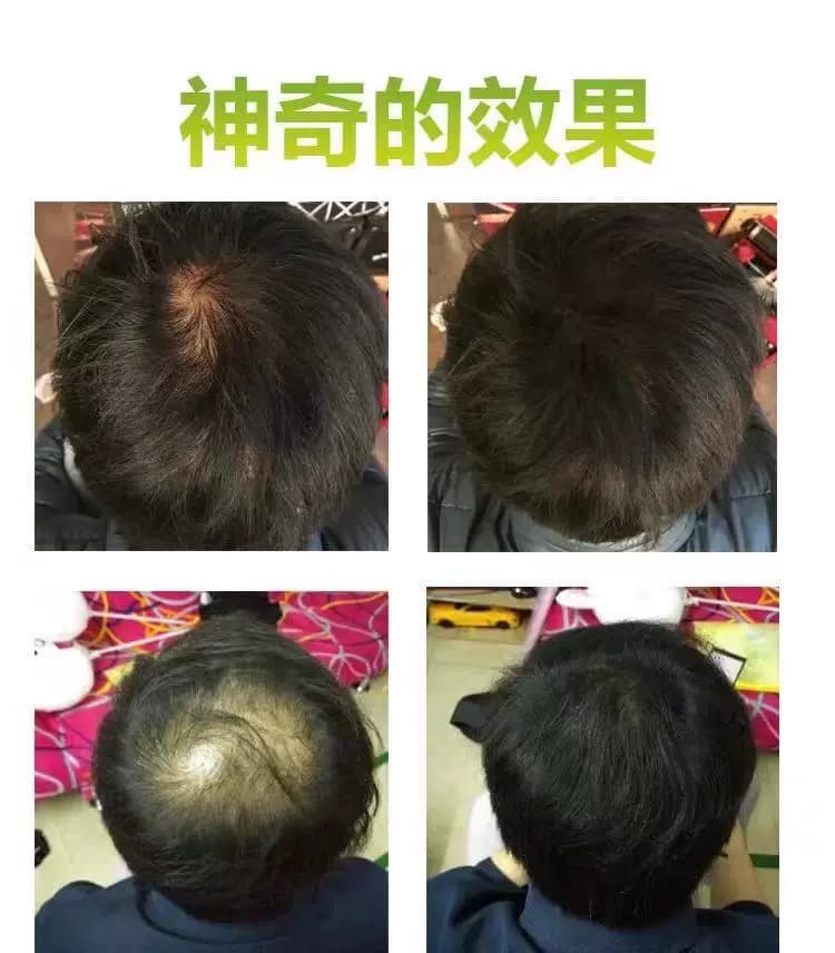 TOPPIK发缝稀少遮秃增发密发补发际线假发填充美发喷雾头发纤维粉 - 缩略图2