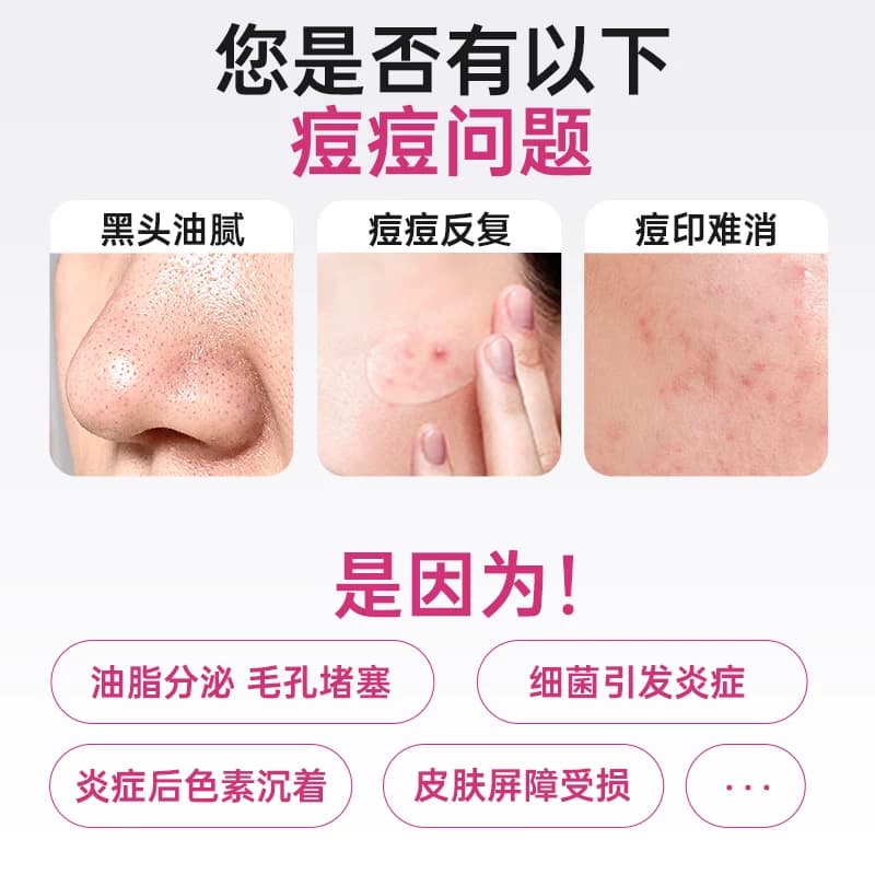 丽芙甲硝唑凝胶正品壬二酸祛痘药膏修护淡化医用消炎痘痘用药药房 - 缩略图2