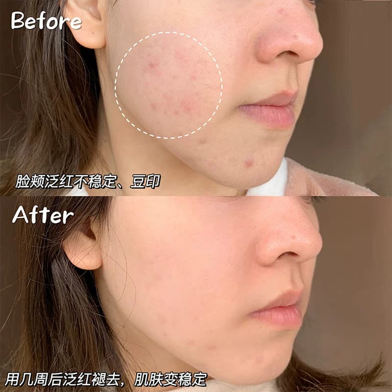 颐莲玻尿酸补水喷雾姬莲化妆水爽肤水清爽保湿持久  新疆西藏停发 - 缩略图4
