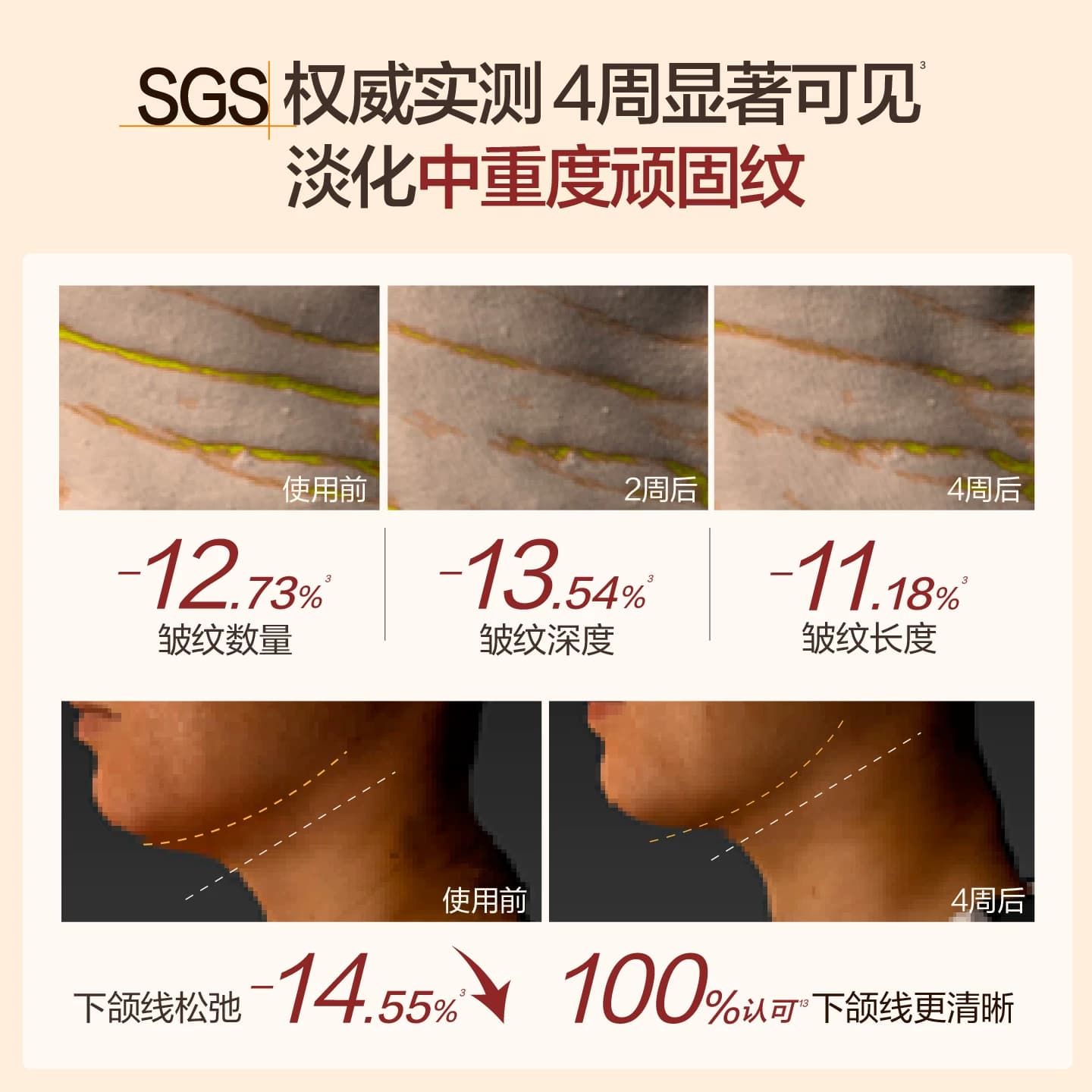 HBN双A醇颈霜2.0视黄醇精华颈纹霜提拉紧致淡化颈纹脖子纹美颈霜 - 缩略图2