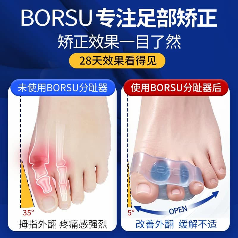 德国BORSU拇指外翻脚趾矫正器硅胶分趾器大拇脚趾分离器可穿鞋套 - 缩略图3