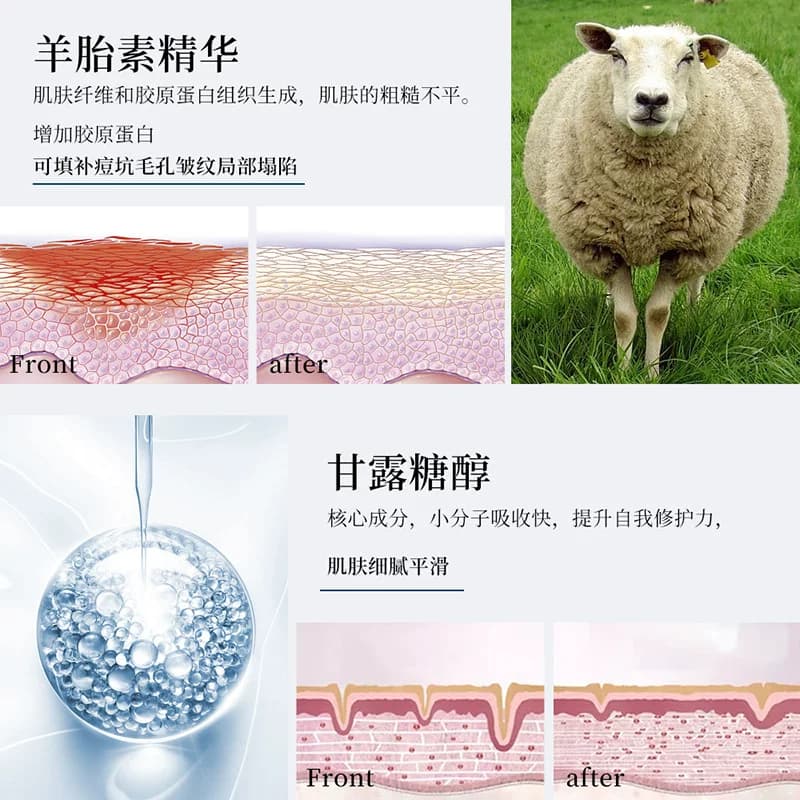 EXGYAN  忆香缘 韩国进口原料羊胎素润护冻干粉化妆品套装正品A - 缩略图4