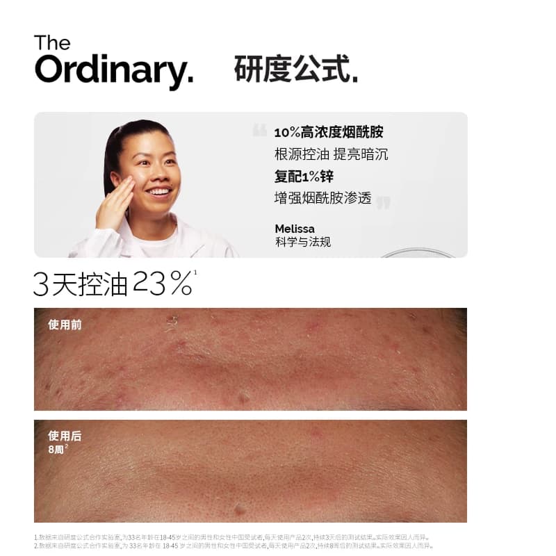 The Ordinary研度公式10%烟酰胺与1%锌精华控油祛痘提亮油皮男女 - 缩略图2
