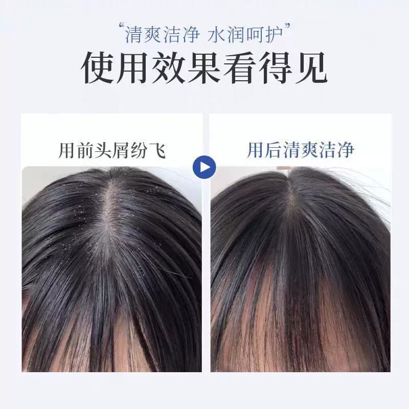 二硫化硒去屑止痒洗发露清爽控油蓬松飘逸清爽头皮男女通用 - 缩略图3