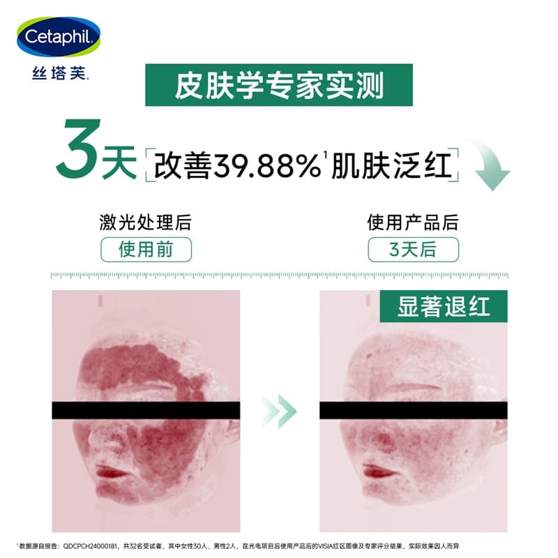 【闪退红敏】丝塔芙cetaphil四维面霜舒缓修护屏障敏感肌补水保湿 - 缩略图3