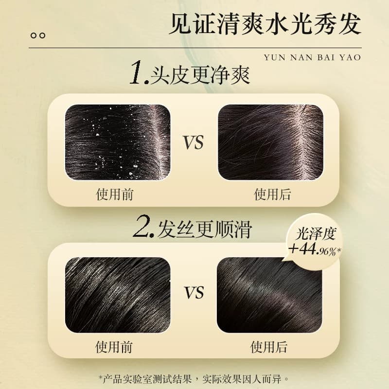 云南白药养元青去屑洗发水柔顺改善毛躁止痒洗发露官方旗舰店 - 缩略图3