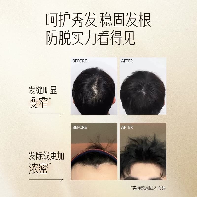 云南白药养元青洗发水男士固发防脱深层控油植物清洁洗发露洗头膏 - 缩略图4