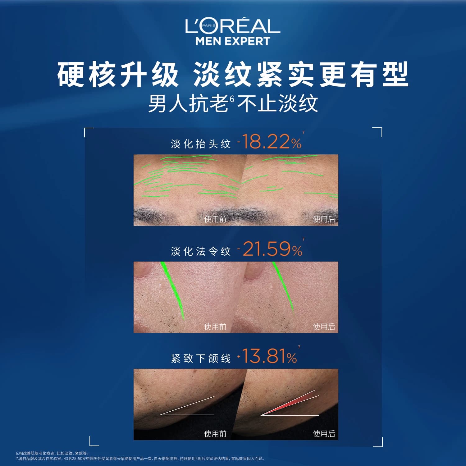 欧莱雅男士淡纹套装紧致抗皱洗面奶水乳保湿控油男生护肤品礼物 - 缩略图4