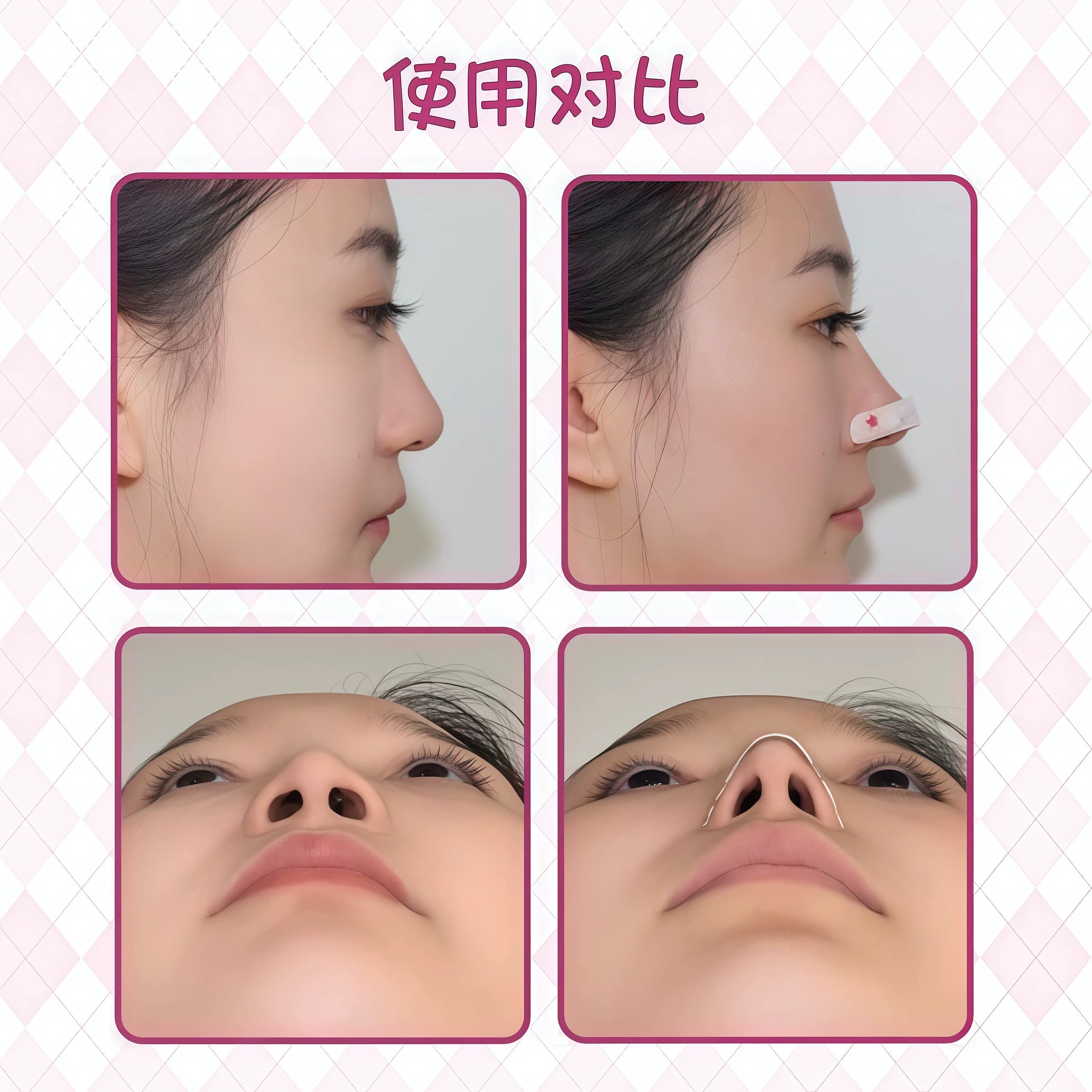 随心塑翘鼻贴鼻孔贴白天出行修饰鼻孔宽大可调节裁剪鼻翼缩小贴矫 - 缩略图4
