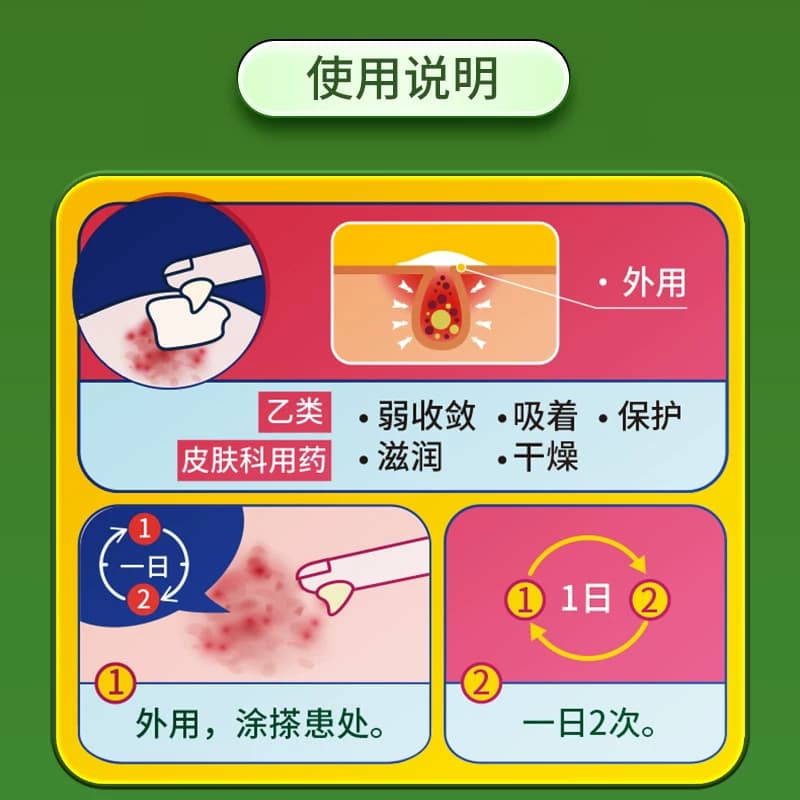 信龙氧化锌软膏婴儿急性皮炎止痒正品湿疹痱子药膏轻度皮肤溃疡 - 缩略图4