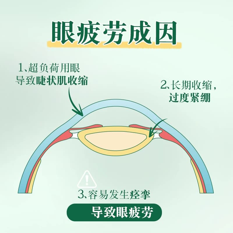 升级】乐敦眼药水新乐敦复方门冬维甘滴眼液眼药水缓解视疲劳干涩 - 缩略图4