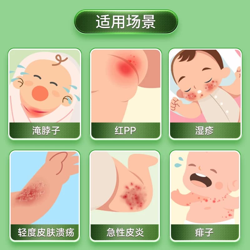 信龙氧化锌软膏婴儿急性皮炎止痒正品湿疹痱子药膏轻度皮肤溃疡 - 缩略图3