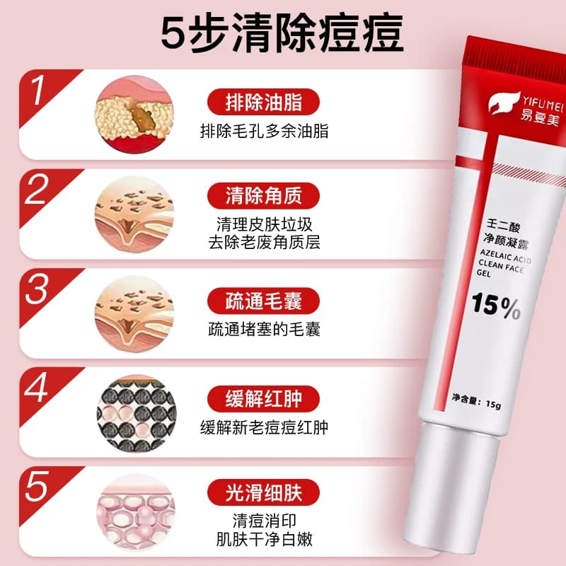 壬二酸凝胶15%去祛痘膏祛痘印淡化坑任水杨酸收缩毛孔非粉刺黑头 - 缩略图2