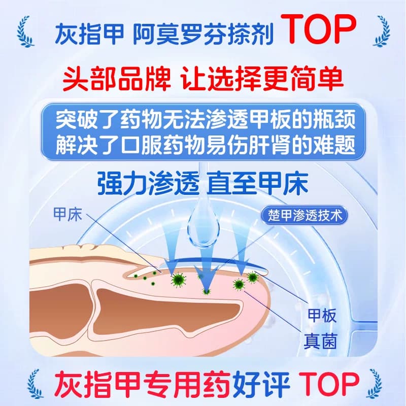 楚甲盐酸阿莫罗芬搽剂正品旗舰店灰指甲专用药盐酸阿罗莫芬药房 - 缩略图2