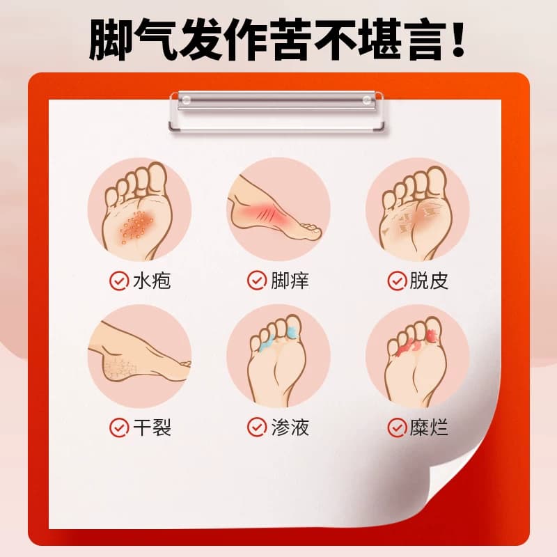 达克宁硝酸咪康唑乳膏正品官方脚气止痒脱皮特比萘芬脚出汗臭糜烂 - 缩略图2