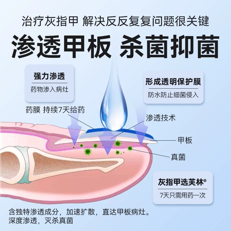 芙林盐酸阿莫罗芬搽剂专用感染旗舰店灰指甲正品官方真菌擦剂溶液 - 缩略图3