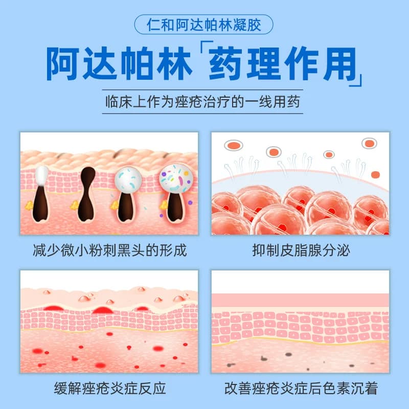 阿达帕林凝胶正品官方旗舰店祛痘药膏林啊达帕林凝胶达怕痘痘药膏 - 缩略图3