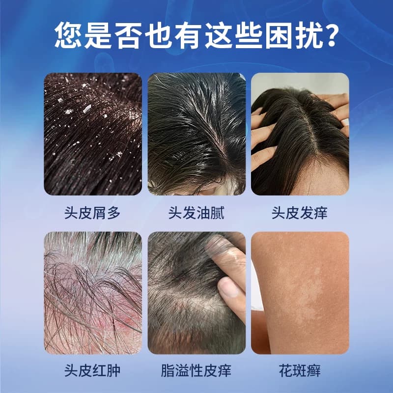 希尔生二硫化硒洗剂二硫化硒洗头水控油洗发水头皮屑专用洗发液 - 缩略图2