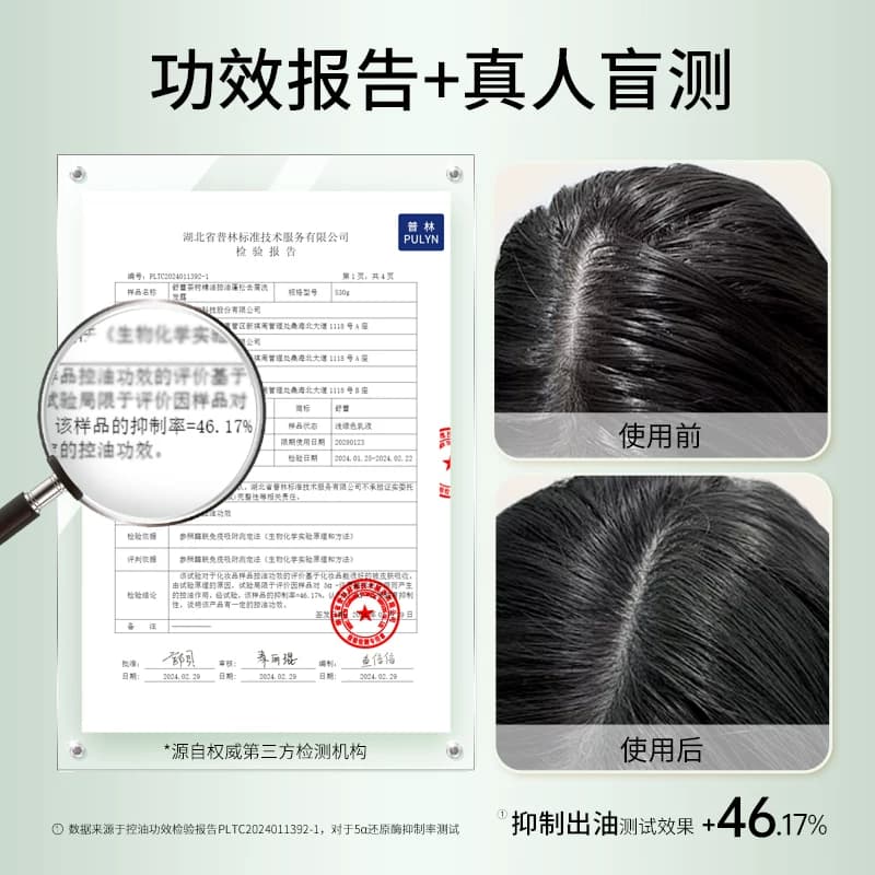 【王星越同款】舒蕾茶树精油控油去屑洗发露蓬松洗发水530g - 缩略图5