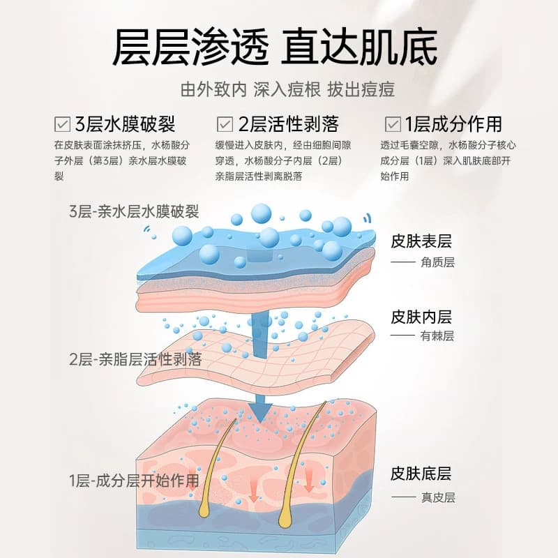 护妍天使祛痘凝胶去角质控油升级抗痘水杨酸凝胶精华祛痘膏10ml - 缩略图3