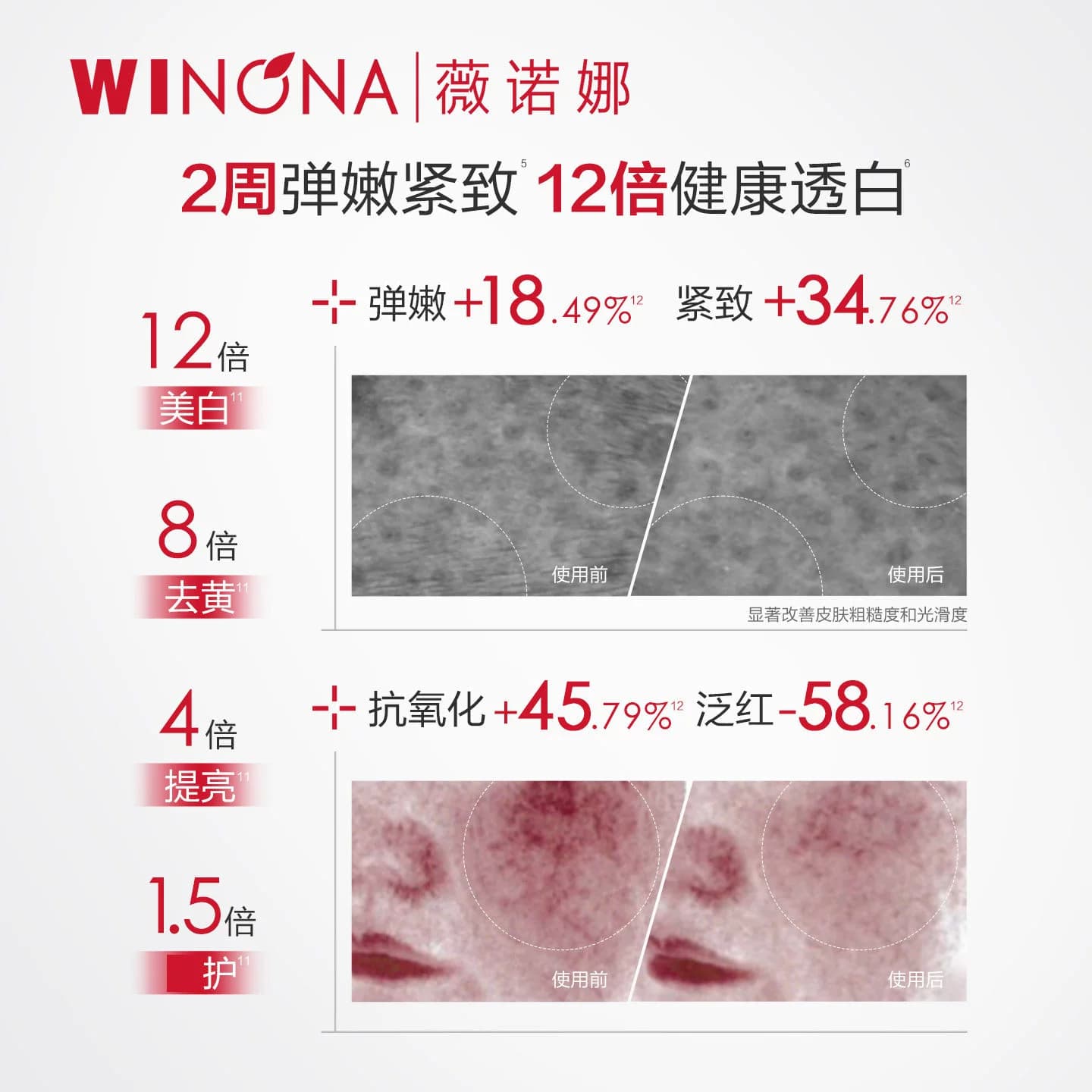 薇诺娜修白水乳霜洁面套装光透皙白洁面乳晶粹水焕亮乳液防晒霜HD - 缩略图3