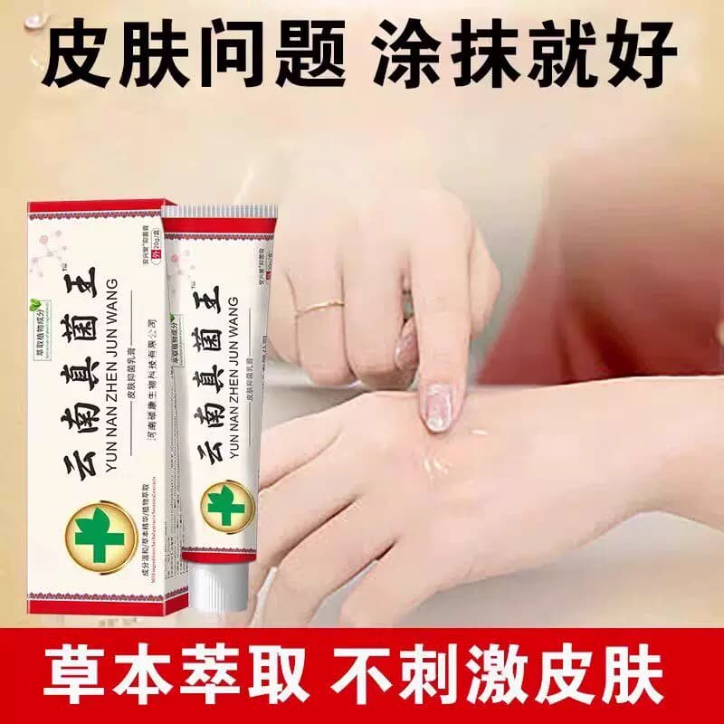 云南真菌王正品特效皮肤外用全身手脚痒止膏皮炎草本内侧舒缓褪红 - 缩略图4
