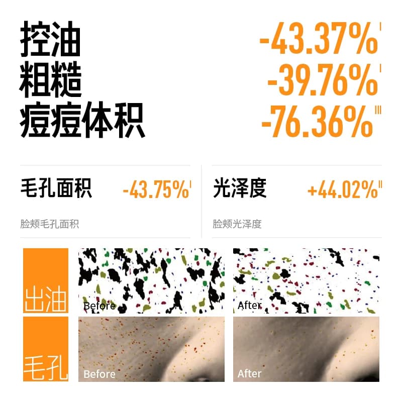 毕生之研五环油皮水乳套装磨皮精华控油祛痘收缩毛孔去闭口女男士 - 缩略图2