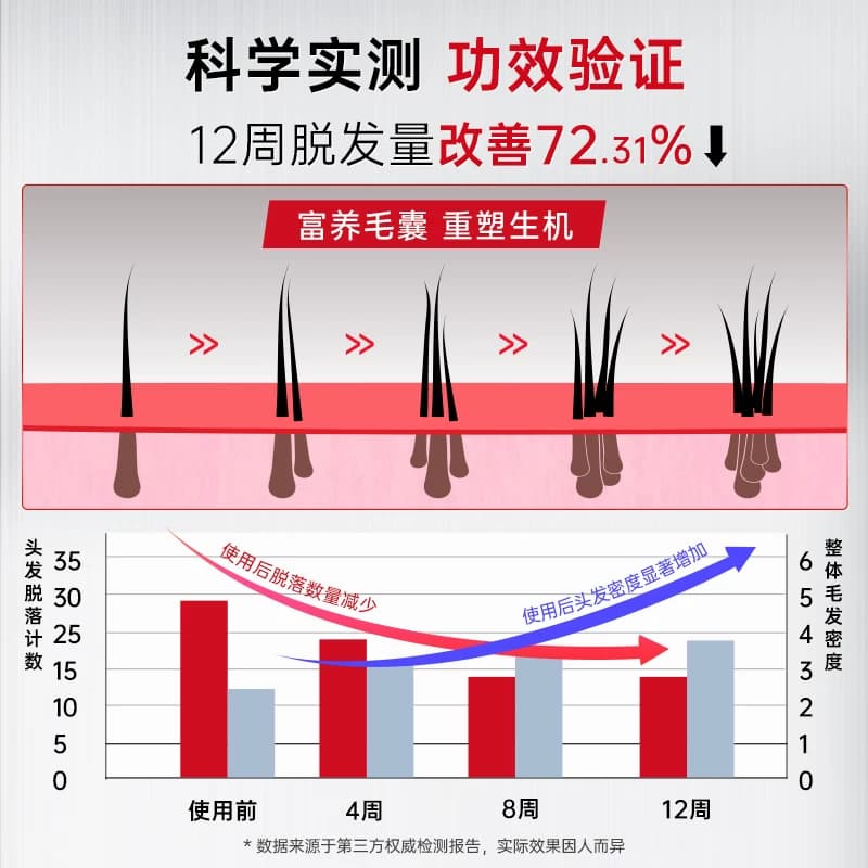 卡蓓诺防脱洗发水固发密发护发蓬松控油精华防脱发洗发露液进口 - 缩略图4