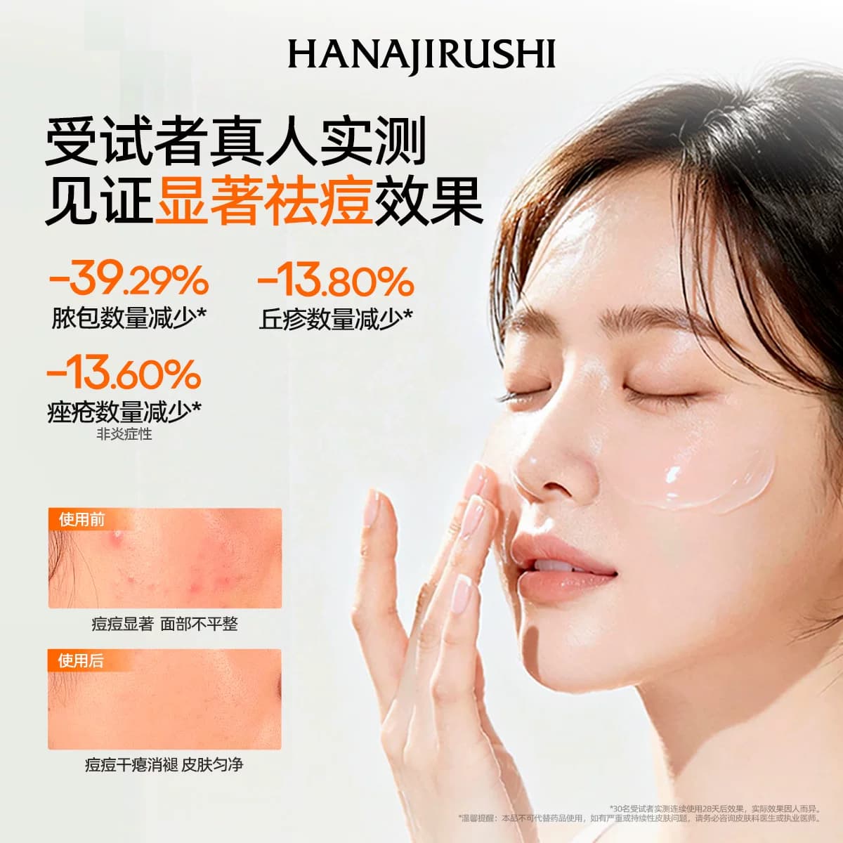花印进口祛痘凝露精华凝胶青春痘痘坑痘疤芦荟胶淡化痘印官方旗舰 - 缩略图3