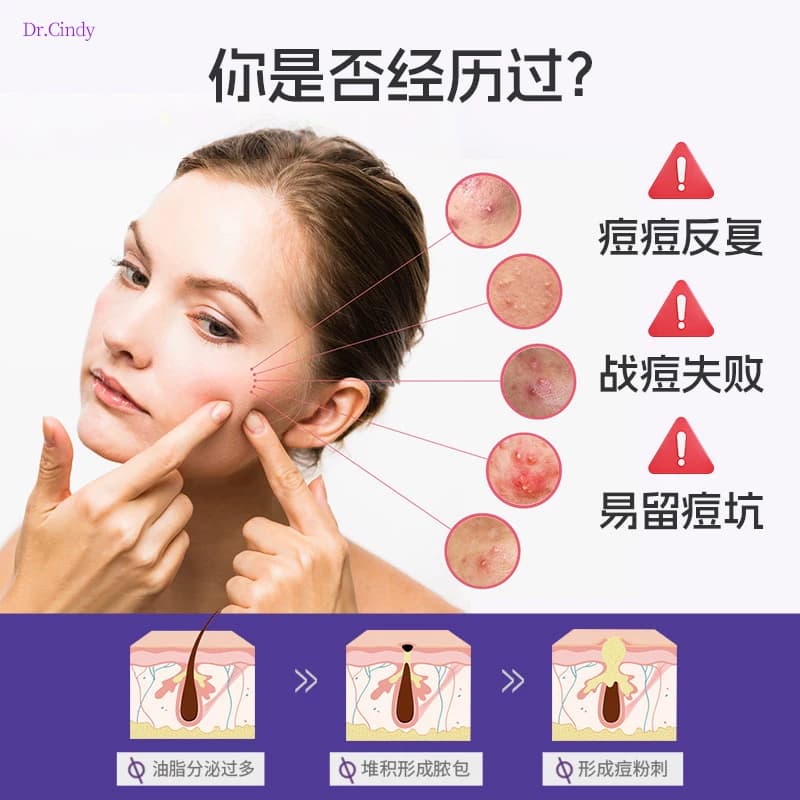 医用痘痘贴吸脓净痘日夜两用隔绝污染上妆隐形遮瑕水胶体敷料械字 - 缩略图2