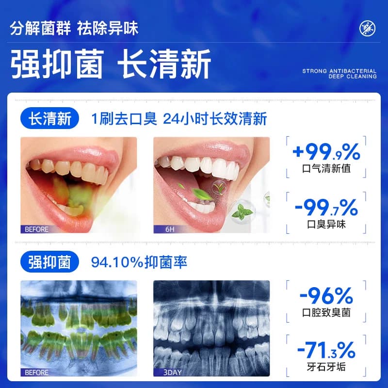 舒客牙膏清新盾牙膏清火护龈去异味去口臭改善牙龈红肿男女士牙膏 - 缩略图3