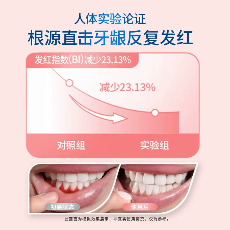 【下拉直播间有库存】冷酸灵医研牙龈修护牙膏牙齿抗敏感成人护龈 - 缩略图4