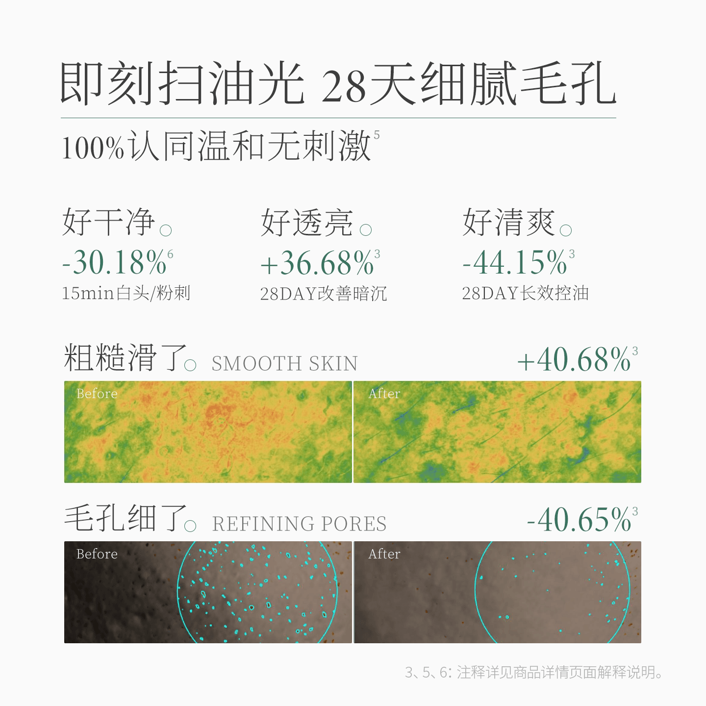 【去黑头细毛孔】一叶子酸酶泥膜净肤控油清洁敏肌透亮祛痘面膜 - 缩略图3