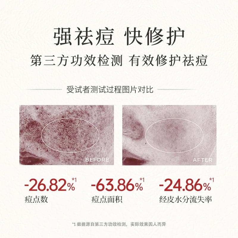 ALODERMA瑷露德玛芦荟胶补水保湿正品官方凝膏祛痘面霜专用女舒缓 - 缩略图3