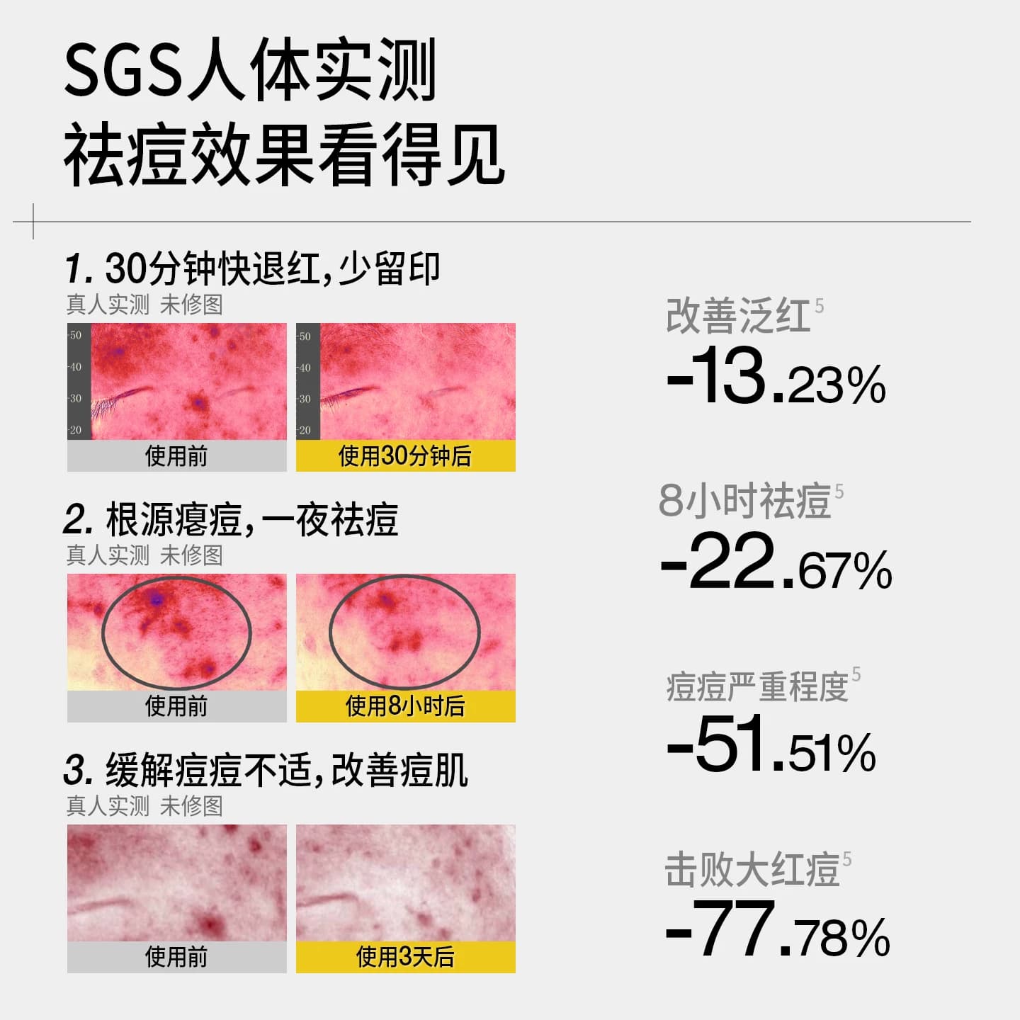 【陈梦推荐】羽素祛痘大灯泡精华液无酸胶态硫舒缓修护淡化痘印女 - 缩略图4