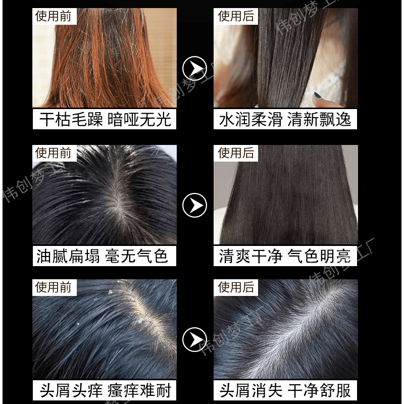 美兰迪洗发水露去屑止痒育发防控油蓬松脱发去屑洗头膏露男女正品 - 缩略图4