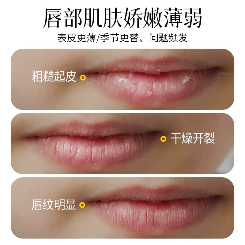 skinvape未来润唇膏凡士林护唇膏保湿滋润唇油去死皮唇膜官方正品 - 缩略图2