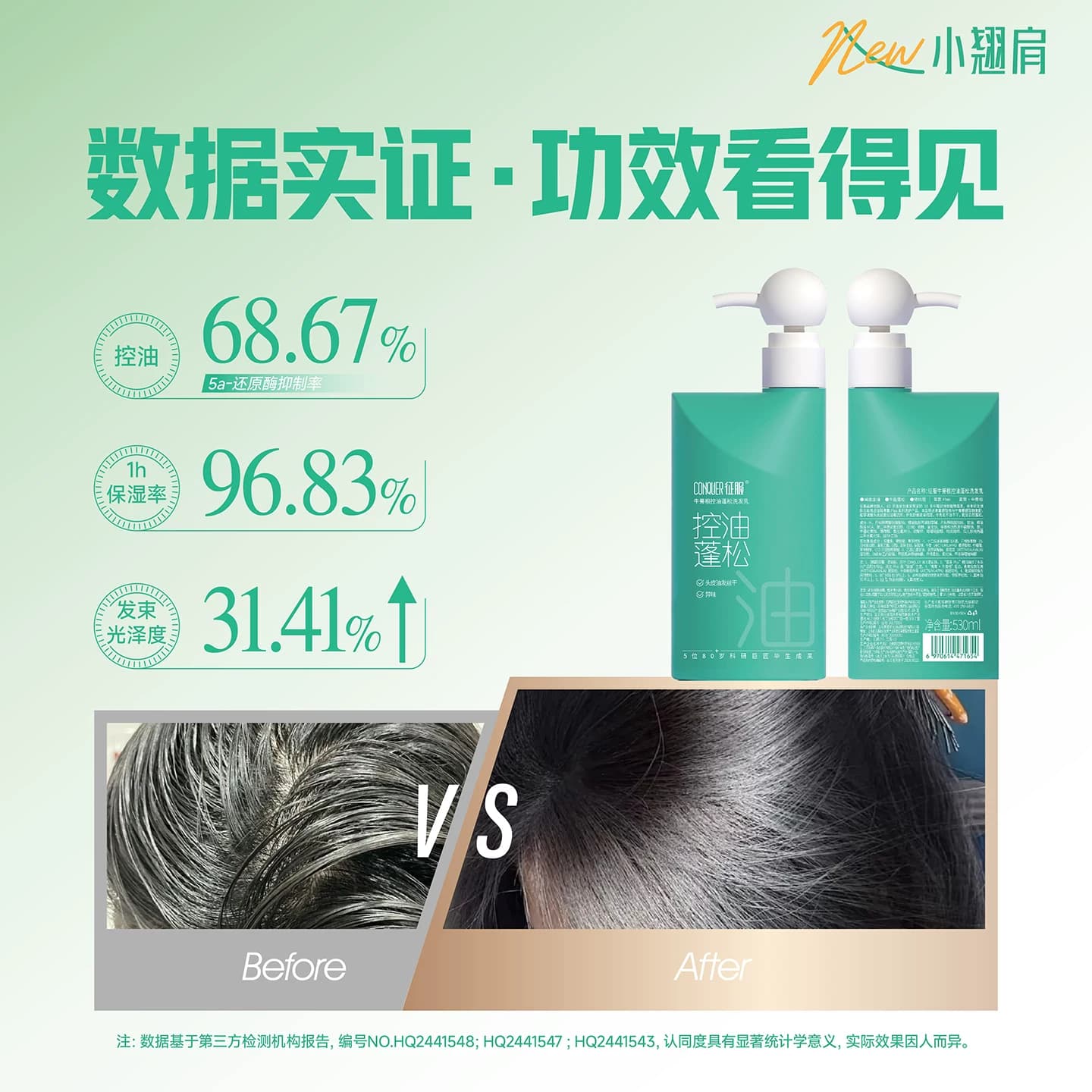 征服青蒿洗发水控油蓬松去屑柔顺青蒿洗发露礼盒装官方旗舰店 - 缩略图4