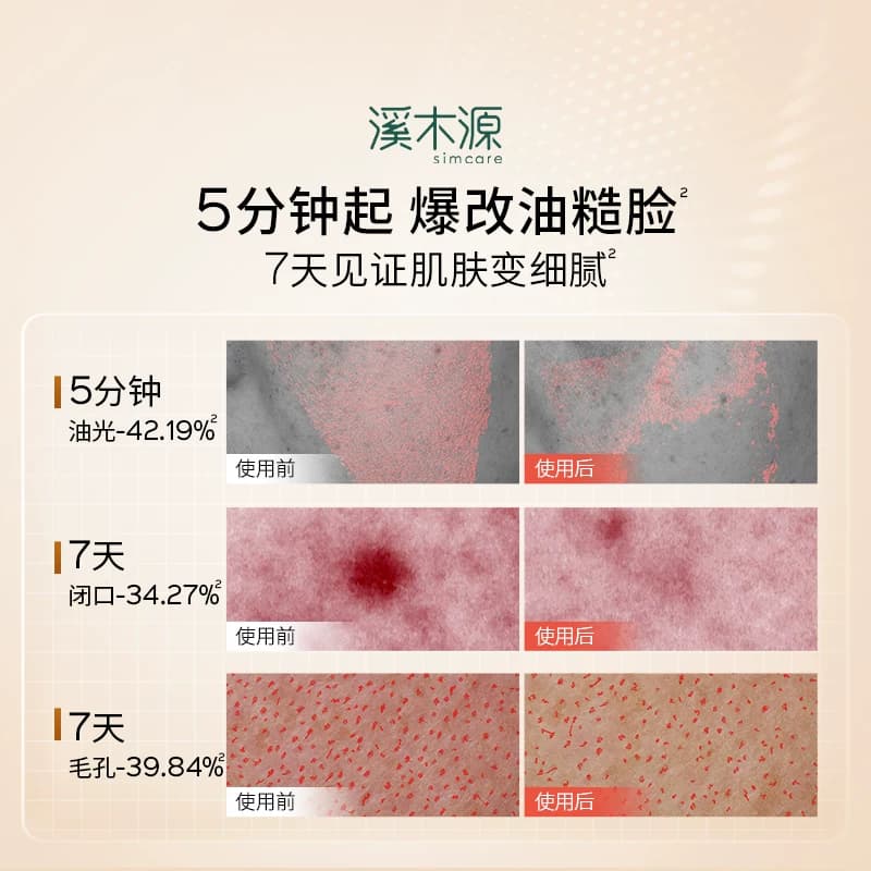 溪木源层孔菌智控水油皮敏感肌爽肤水无酸控油补水喷雾湿敷精华水 - 缩略图2