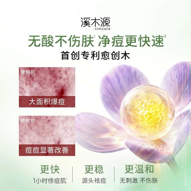 溪木源愈创木精华液无酸祛痘油痘敏感肌去痘淡印修红护肤品女男 - 缩略图4