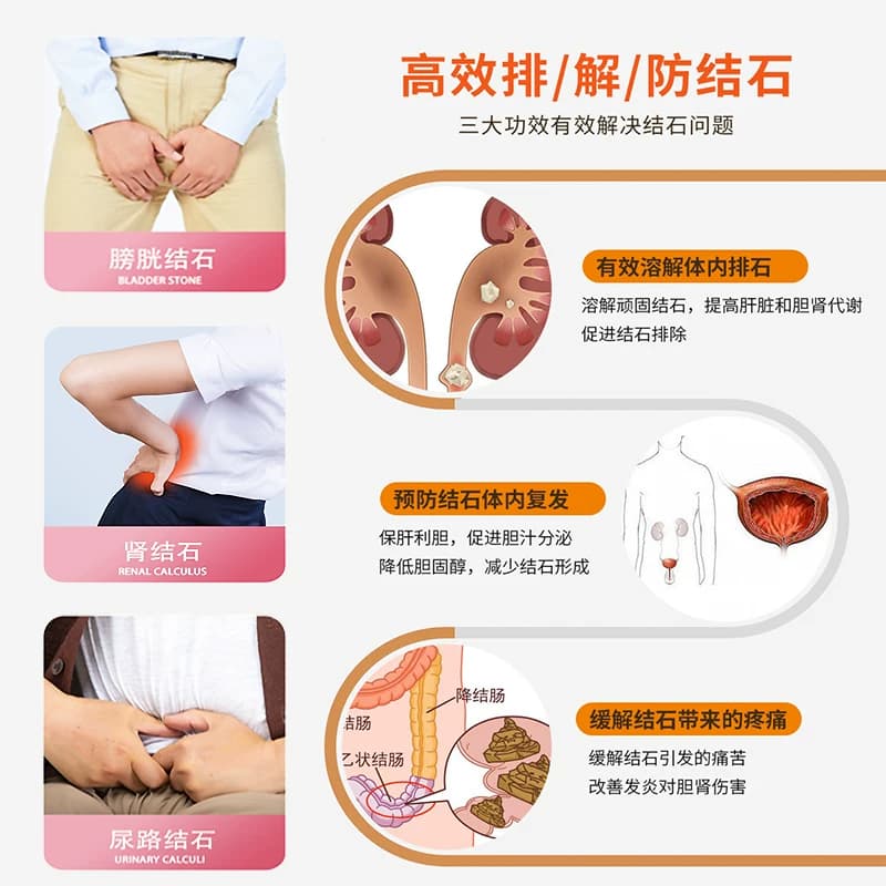 德国配方强力消石素香港原装进口德华沙利石素溶石肾结石排石药 - 缩略图2