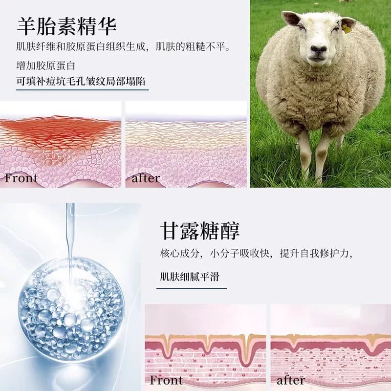EXGYAN  忆香缘 韩国进口原料羊胎素润护冻干粉化妆品套装正品2 - 缩略图4
