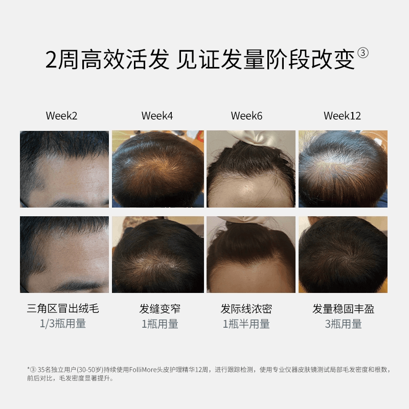 FolliMore精华活发护理因子丰盈发丝柔顺滋养温和免洗滋养头皮 - 缩略图4