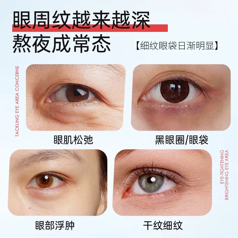 眼部紧致微针眼霜改善皱纹紧致霜水嫩补水保湿改善细纹淡化黑眼圈 - 缩略图3
