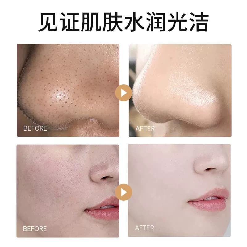 涂抹撕拉面膜去黑头粉刺泥膜深层脸部毛孔清洁神器正品 - 缩略图5