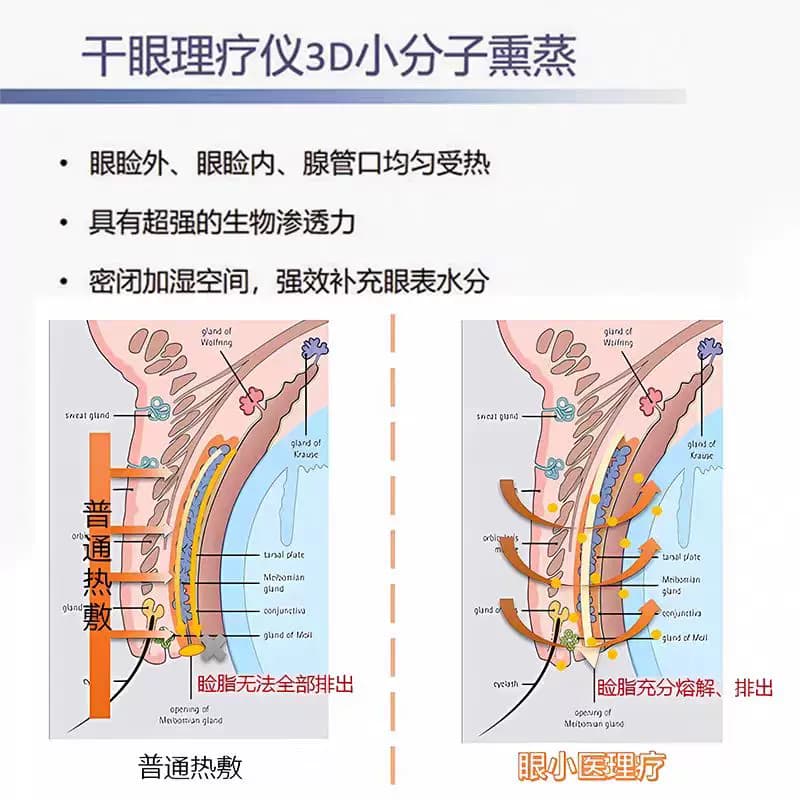 眼部可视化理疗仪眼部spa熏蒸干眼护眼仪缓解眼干眼疲劳顺丰发货 - 缩略图5