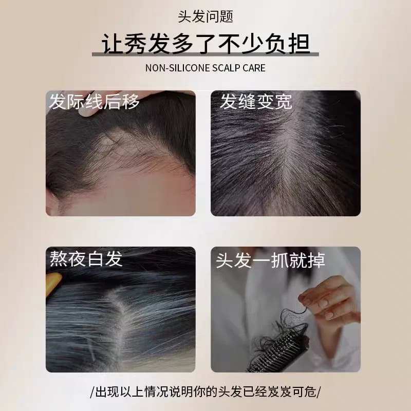 【强韧发根】头发滋养精华液生长液男女通用1 - 缩略图2