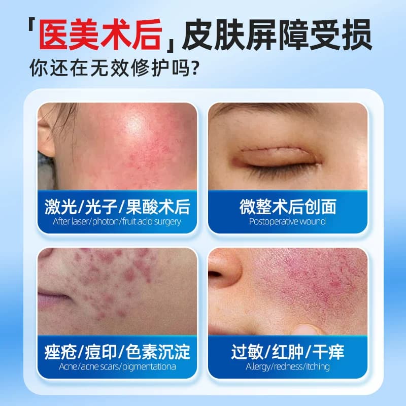 医用胶原蛋白敷料冷敷贴非面膜型医美械准字号水光针术后修复补水 - 缩略图2
